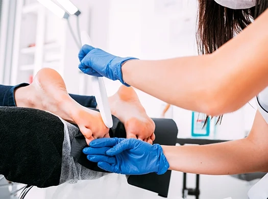 Pé de atleta e outras micoses