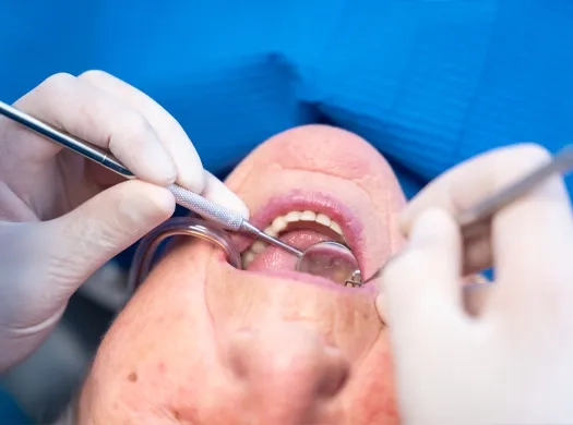 Infeção ou inflamação da polpa