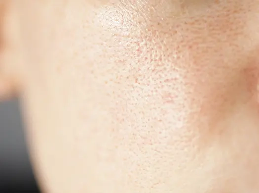 Envelhecimento da pele