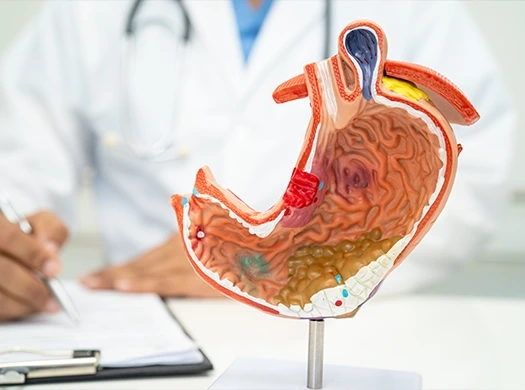 Hipertensão (pressão alta)