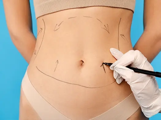 Hipertensão (pressão alta)